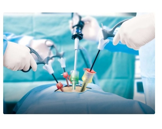 Best Laparoscopy Hospital In Bangalore