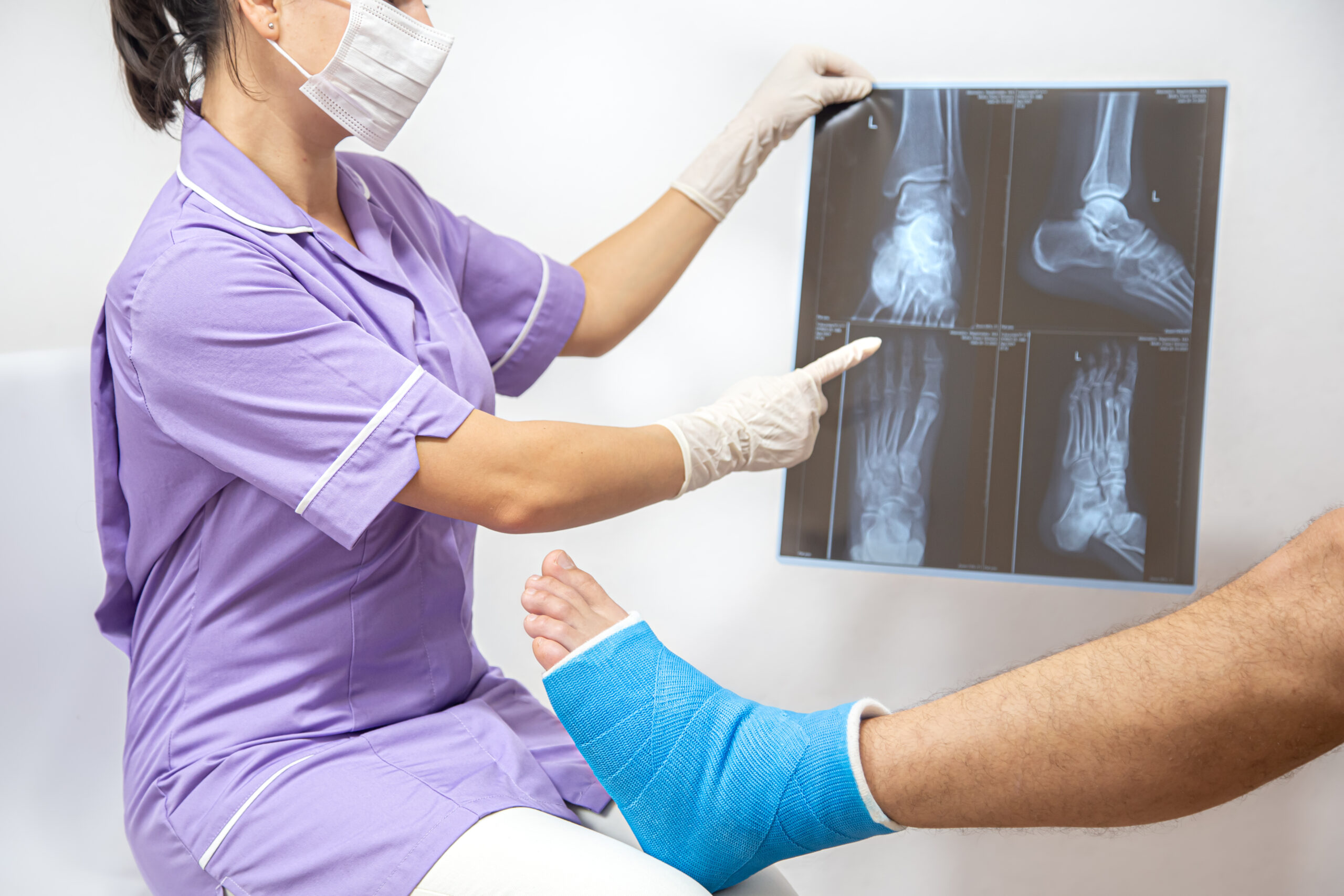 Podiatric Surgery in Bangalore